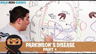 Parkinsons Disease  Clinical Presentation  Part 1 [upl. by Edward]