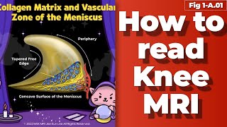Fig 1A01 Collagen Matrix And vascular zone of the meniscus [upl. by Ronnica182]