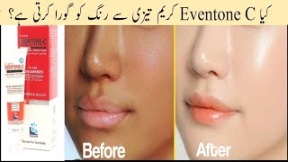 Eventone C medicated Whitening cream Review  Eventone C to Treat Skin Darkness [upl. by Cilo]