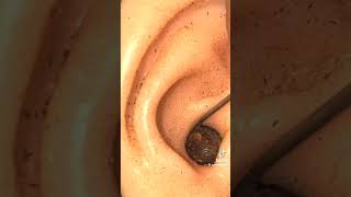 How to Safely Clean Your Ears and What to Absolutely Not DoAug 11 2023 — [upl. by Kletter]