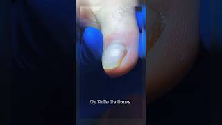 Cute nails satisfying pedicure satisfying pedicure nails [upl. by Marlo841]