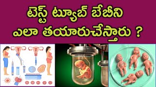 టెస్ట్ ట్యూబ్ బేబీని ఎలా తయారుచేస్తారు  Test tube baby process in telugu  IUI IVF treatment [upl. by Lirbij795]