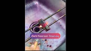 Ziehl Neelsen stainingZN stainingAFB staining Afb tb znstain [upl. by Noseaj]