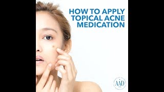 How to apply topical acne medication [upl. by Sadie]