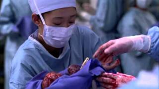 Greys Anatomy  2x10 Fin FR [upl. by Louis]