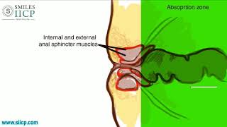 Learn How To Insert Anal Suppository  SMILES Gastroenterology [upl. by Aihsotan]