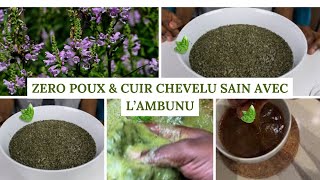 Gardez Votre Cuir Chevelu Sain Avec Cette Plante🌱 [upl. by Nahtal]