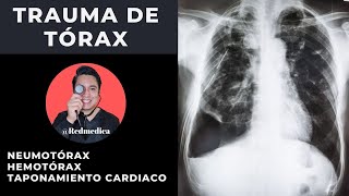 ATLS  Trauma de tórax  ENARM2021  🩺Dr Treviño [upl. by Suoirtemed]