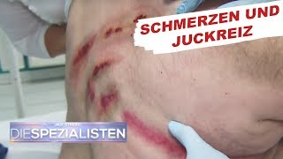 Krasser Hautausschlag  Auf Streife  Die Spezialisten  SAT1 TV [upl. by Monte]