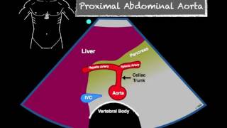 Bedside Ultrasound Abdominal Aorta [upl. by Adeehsar]