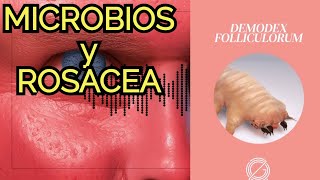 La MICROBIOTA y enfermedades de la piel como la ROSACEA [upl. by Cia357]