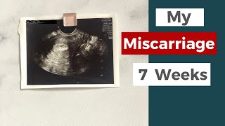 My Early Miscarriage  Miscarriage Symptoms [upl. by Rosemaria]