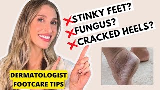 Footcare Tips for Cracked Heels Smelly Feet Toenail Fungus amp More  Dermatologist Dr Sam Ellis [upl. by Eelsnia430]