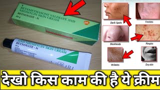 देखो BetnovateN क्रीम की हैरान करने वाली पूरी सच्चाई  BetnovateN cream review  SG support [upl. by Lucretia293]