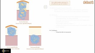 TUTORIEL IMOSTEO 25  Sémiologie des malformations veineuses en imagerie [upl. by Branen]