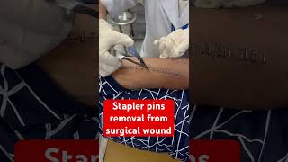 Multiple ways to close a surgical wound 1 nylon sutures 2 skin staplers 3 dermabond woundcare [upl. by Ahseim]