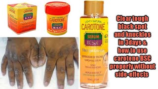 Clear tough spots amp dark knuckles in 3days carotene BSC cream and serum review amp how to use [upl. by Ashling3]