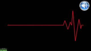 Heartbeat Sound Effect Normal to Slow I Heartbeat Slowing down Sound Effect 1 [upl. by Mayyahk]