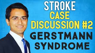 GERSTMANN SYNDROME STROKE CASE PRESENTATION STROKE CASE SCENARIO DISCUSSIONUSMLE [upl. by Yeldoow997]