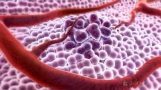 3D Medical Animation  What is Cancer [upl. by Nwahsud]