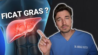 7 REGULI pentru un FICAT GRAS 👨🏼‍⚕️ experienta unui chirurg [upl. by Niamrej]