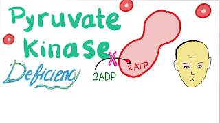 Pyruvate Kinase Deficiency  Hemolytic Anemia [upl. by Marsden]