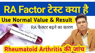 What is RA Factor  Rheumatoid FactorTest  its Use Normal Range and Result in Hindi [upl. by Sillig543]