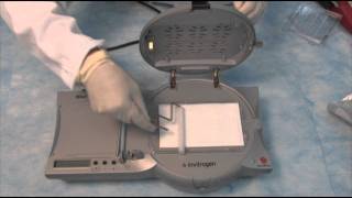 How to set up a Western part 3  The Blot Transfer using the iBlot® [upl. by Tye]