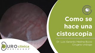 CISTOSCOPIA URETROSCOPIA DIAGNOSTICA [upl. by Goldston]