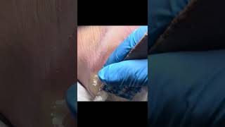 Charming Pedicure Video  Remove Dead Skin [upl. by Woodcock]