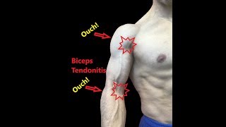 Biceps Tendonitis  Exercises And Myofascial Release [upl. by Lauber]