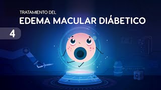 Tratamiento para el edema macular diabético  cómo evitar la ceguera por diabetes [upl. by Eislek]