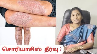 Psoriasis Solutions   DrA Anitha Yugeshwaran BSMS sivanisiddha dranitha psoriasiscure [upl. by Swanhildas]