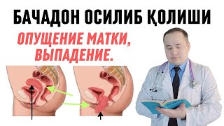 АЁЛ МАТКАСИ ТУШИШИ ОПУЩЕНИЕ МАТКИ САБАБЛАРИ БЕЛГИЛАРИ АЁЛЛАР МАТКАМ ТУШМАСИН ДЕСАНГИЗ КЎРИБ ҚЎЙИНГ [upl. by Yrtneg]