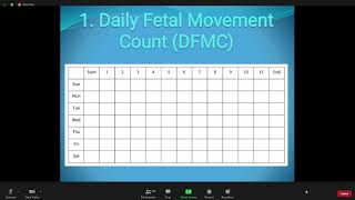 Fetal Non Stress Test [upl. by Etireugram]