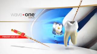 WaveOne® Gold  Product overview with Dr Bergo  Dentsply Sirona [upl. by Onitsuj]