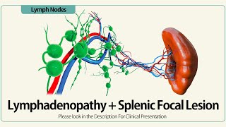 Lymphadenopathy and Splenic Focal Lesion [upl. by Humfrey217]