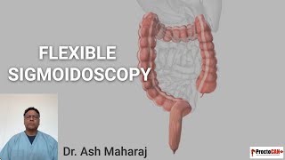 Flexible Sigmoidoscopy [upl. by Pallaton]