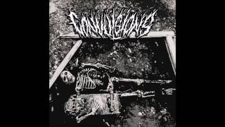 Convulsions  ST EP 2016 Full Album HQ Grindcore [upl. by Aihtenyc927]