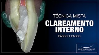 COMO REALIZAR CLAREAMENTO INTERNO PASSO A PASSO DA TÉCNICA MISTA [upl. by Kasper]