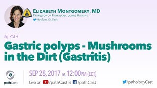 Gastric polyps  Mushrooms in the dirt GASTRITIS [upl. by Dorran762]