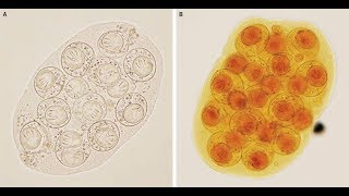 DipylidiumCaninum Infektion mit Gurkenkernbandwurm [upl. by Araed693]