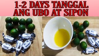 Mabisang Gamot sa Ubot Sipon  12 days tanggal ang iyong sakit [upl. by Marashio]