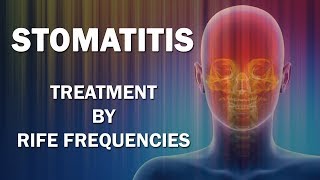 Stomatitis  RIFE Frequencies Treatment  Energy amp Quantum Medicine with Bioresonance [upl. by Jowett]