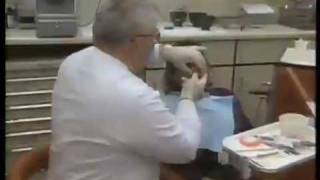 Complete Denture Overview [upl. by Yorgerg]