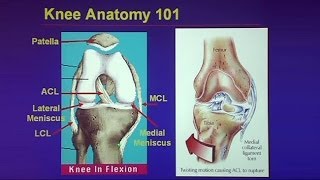 Common Traumatic Knee Injuries Oh My Aching Knee [upl. by Asen]