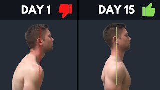 SUPER SIMPLE amp Effective Fix For Rounded Shoulders amp Forward Head Posture [upl. by Jopa808]