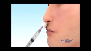 Intranasal nose to brain drug delivery system [upl. by Sheff]