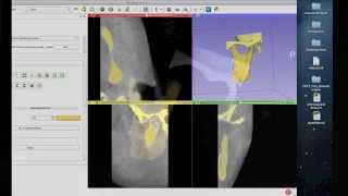 Tutorial Preparing Data for 3D Printing Using 3D Slicer [upl. by Chandal]