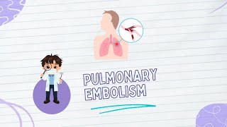 Pulmonary embolism Pathophysiology Types diagnosis amp Treatment [upl. by Gridley370]